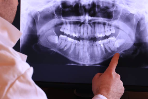 Best Dentist for Tooth Abscess  in Peachtree Corners, GA