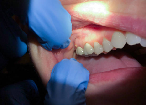 Emergency Dentist for Kids in GA