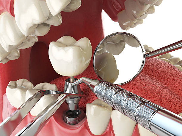 Best Broken Tooth Emergency  in Peachtree Corners, GA